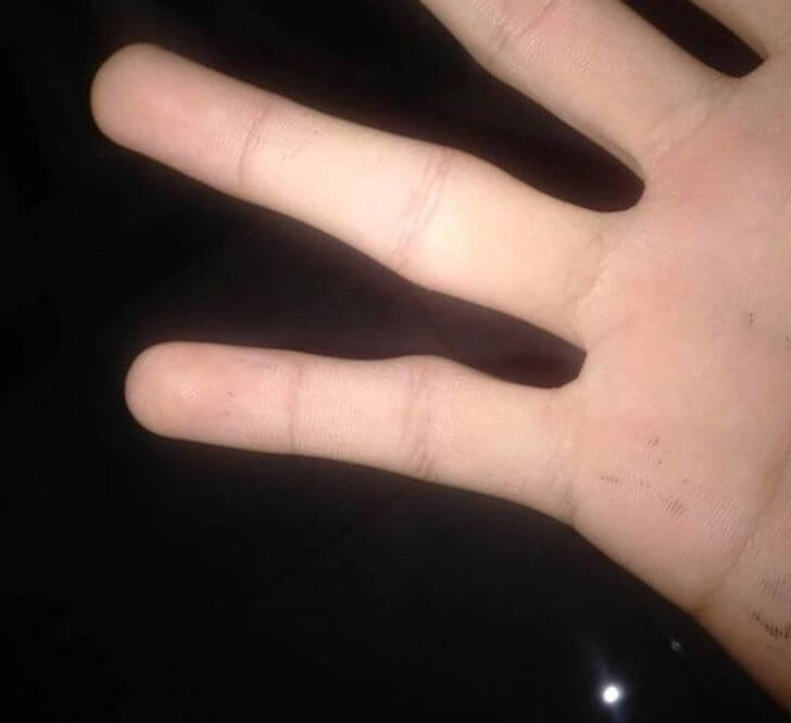 ۷ نوع آسیب جدی و خطرناک استفاده بیش از حد از گوشی های هوشمند